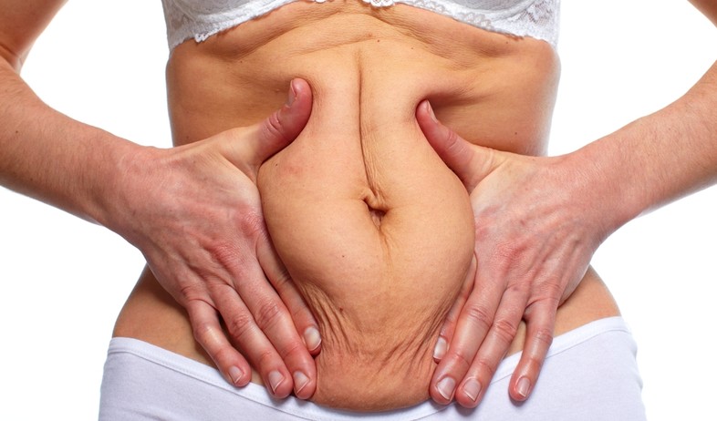 אישה עם עור עודף  (צילום:   kurhan, shutterstock)