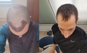 יניב לפני ואחרי (צילום: איתי דגן )